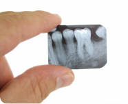 Рентген детских зубов